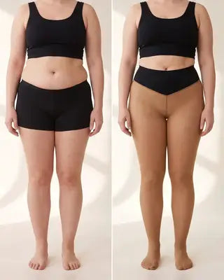 Before and after, front